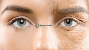 Uban Mengeriput Puisi Abid Alhikam