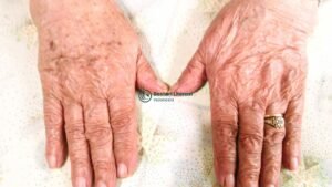 Telepon Tengah Malam - Puisi Nuraini